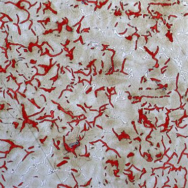 Анализ пластинчатого графита в чугуне с помощью нейромоделей SIAMS